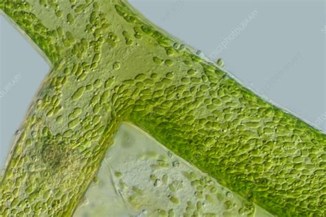  Vaucheria:  A Filamentous Green Alga That Exhibits Remarkable Gliding Motility and Photosynthetic Capabilities!